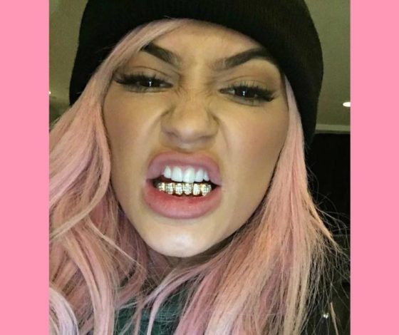 Провели опрос: как парни относятся к грилзам у девушек