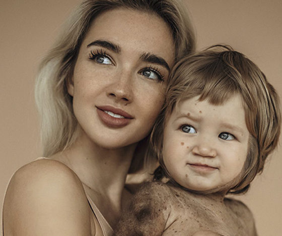 Мама может: Екатерина Мезенова о том, как не сдаваться, даже если у твоего сына страшный диагноз