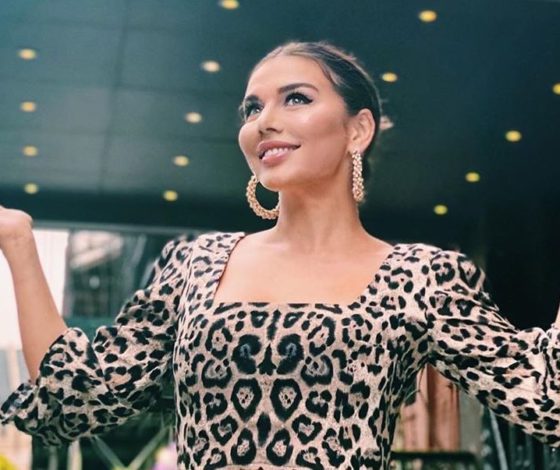 Лайфхак Анны Седоковой: как сделать «лисий взгляд» без операций