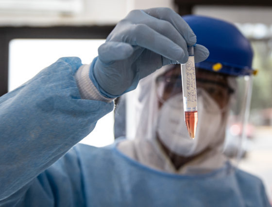 23 июля и коронавирус: больше 15 миллионов заболевших, в США почти 4 миллиона зараженных, в Вашингтоне ввели масочный режим