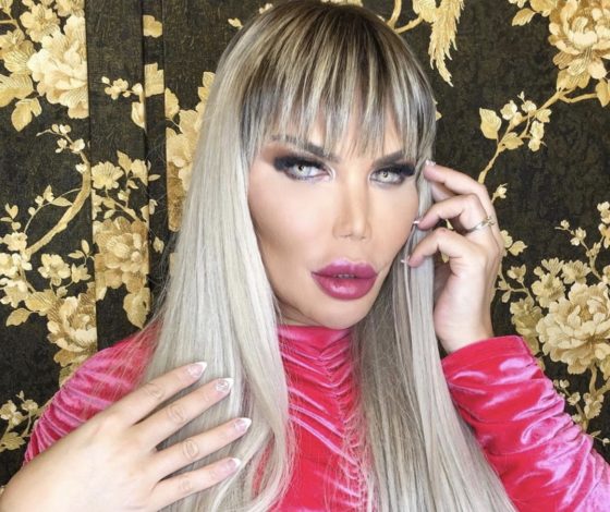 Трешачок: королева пластики из Instagram