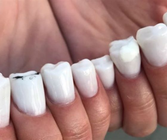 Трешачок: ужасный маникюр, который будет сниться в кошмарах