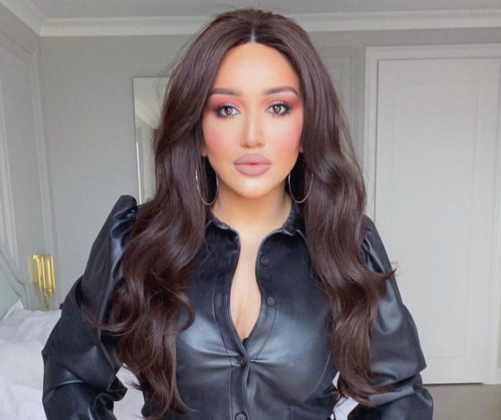 Гоар Аветисян показала результат после пластических операций