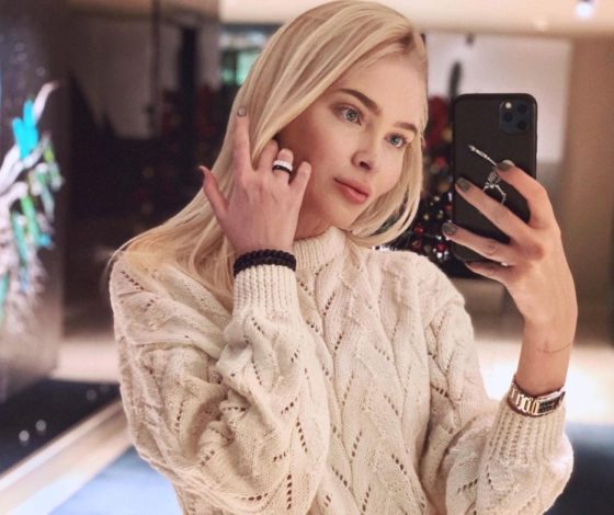 Алена Шишкова ответила на обвинения в пластике