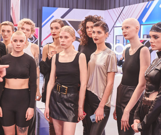 Эксклюзив: модель с алопецией станет участницей проекта «Ты – топ-модель на ТНТ»