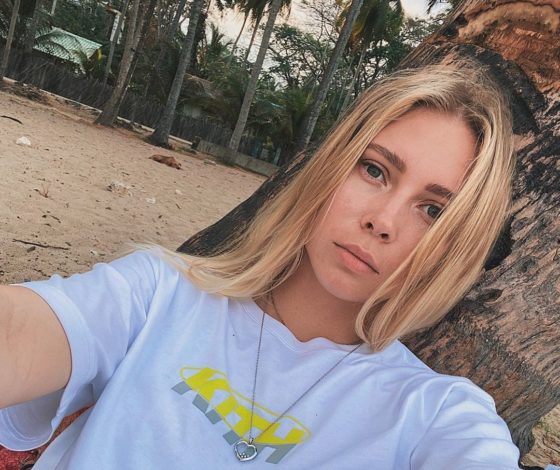 Юлия Коваль рассказала о домашнем насилии: «Остался шрам»