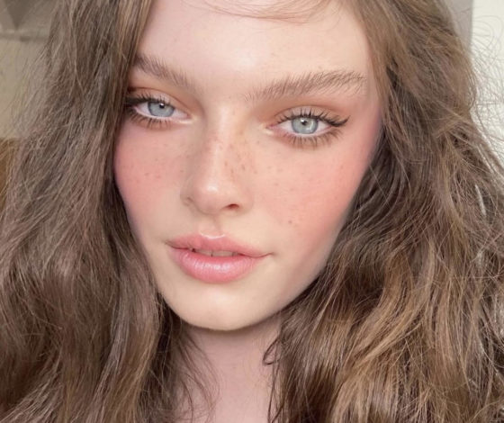 Пигментные пятна: причины появления и варианты лечения