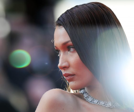 От ринопластики до резекции ребер: сколько стоят фигура, как у Ким Кардашьян, и лицо, как у Беллы Хадид?