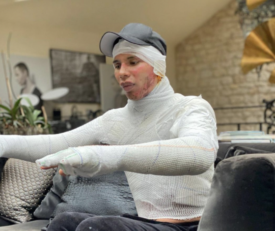 «Мода спасает»: креативный директор Balmain впервые рассказал о том, как чуть не погиб год назад