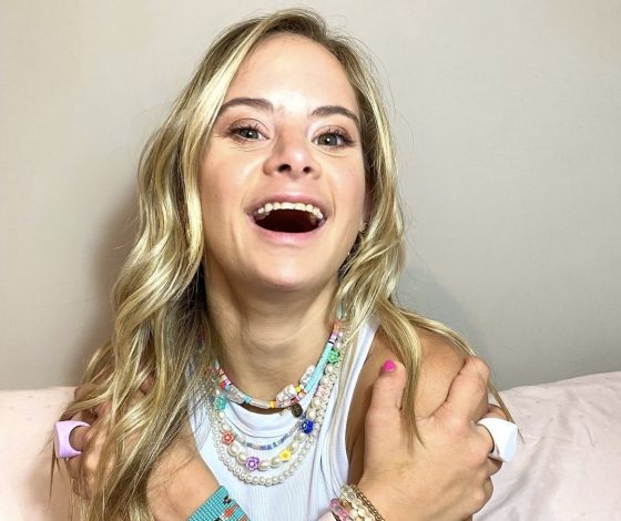 Модель с синдромом Дауна впервые стала лицом Victoria’s Secret