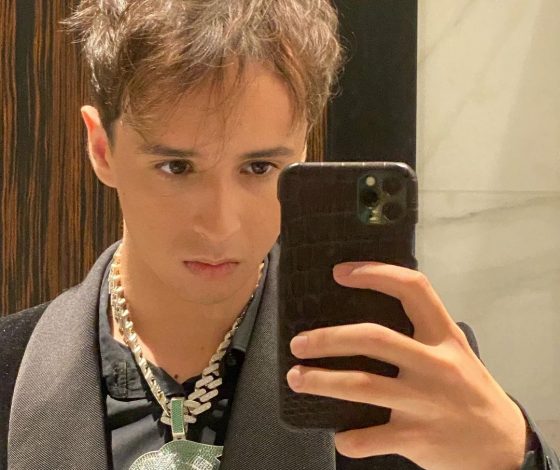 Слава Марлоу показал результат после пересадки волос