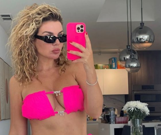 Анна Седокова рассказала, как поборола переедание