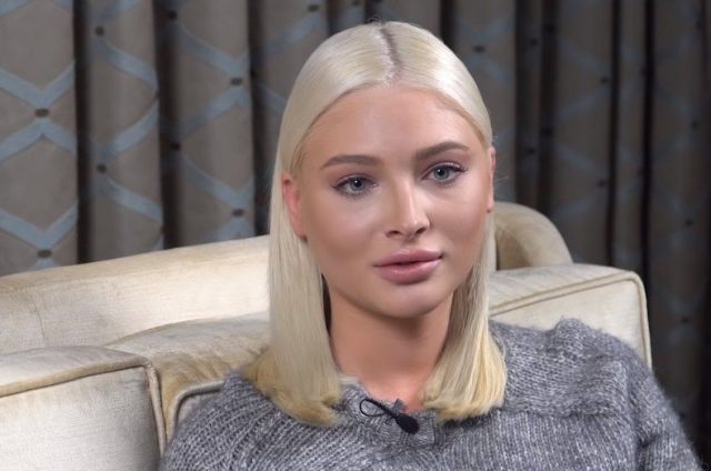 What happened to Alena Shishkova’s face? the beautician tells | The ...