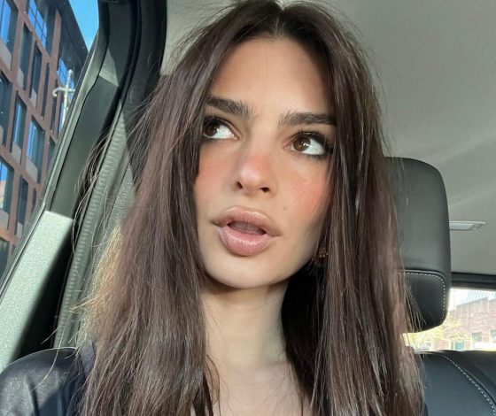 Смелое решение: Эмили Ратаковски сочетает леопардовый купальник с мини-юбкой