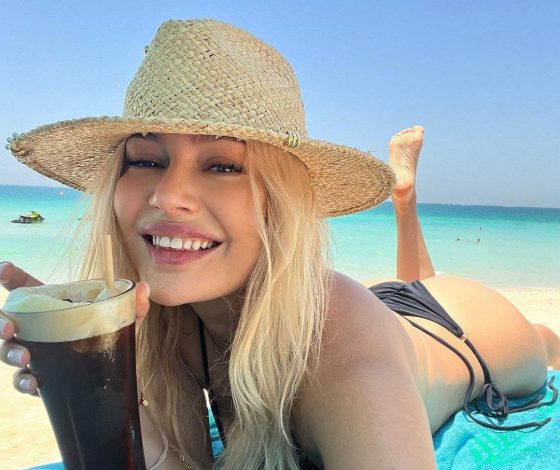 «Подруга Джокера»: Наталья Рудова удивила фанатов новыми снимками