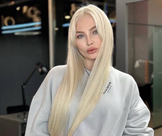 Алена Шишкова решилась на пластику