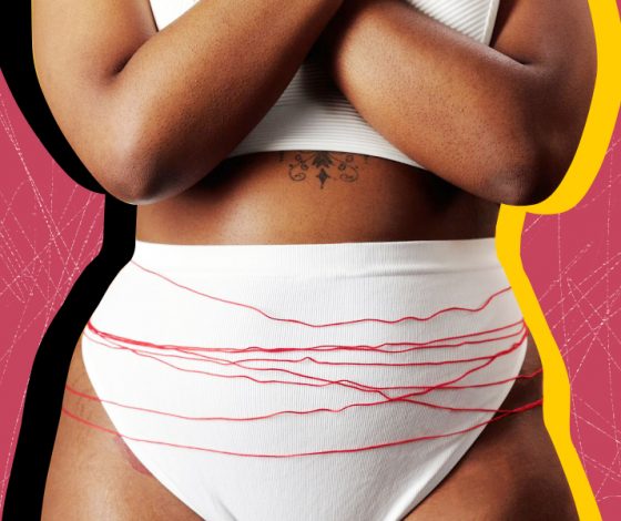 Похудение без усилий: правда ли аппараты EMSclulpt Neo и RSL эффективнее, чем спортзал?