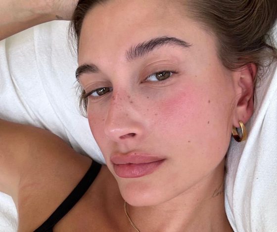 3 крема для кожи вокруг глаз против отеков