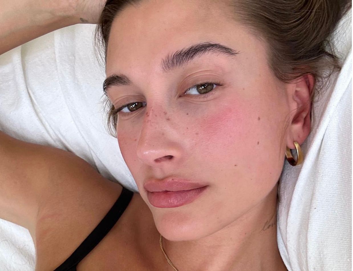 3 anti-swelling creams for the skin around the eyes