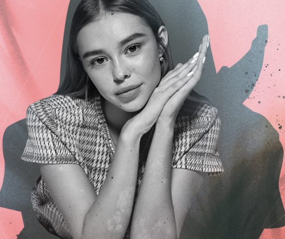 «Я говорила всем, что это аллергия»: личная история о жизни с псориазом