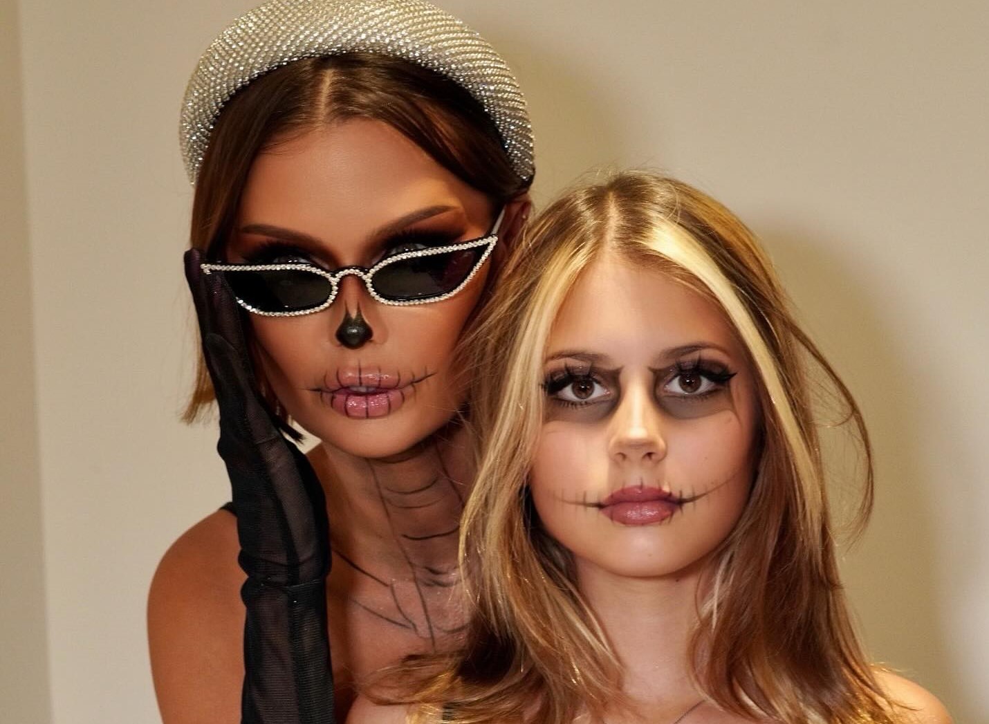 Victoria Bonya showed the result of plastic surgery worth more than 20 million rubles for free