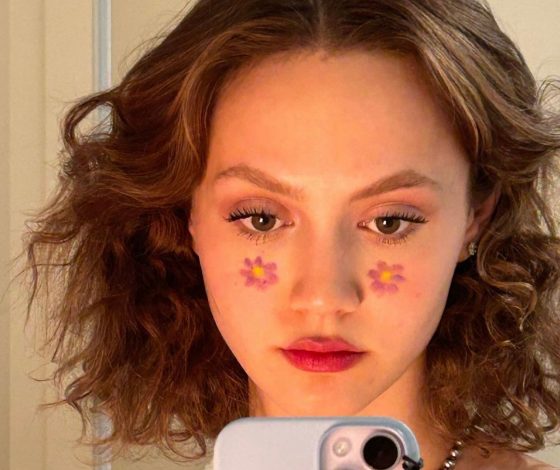 Что такое постакне и как с ним бороться