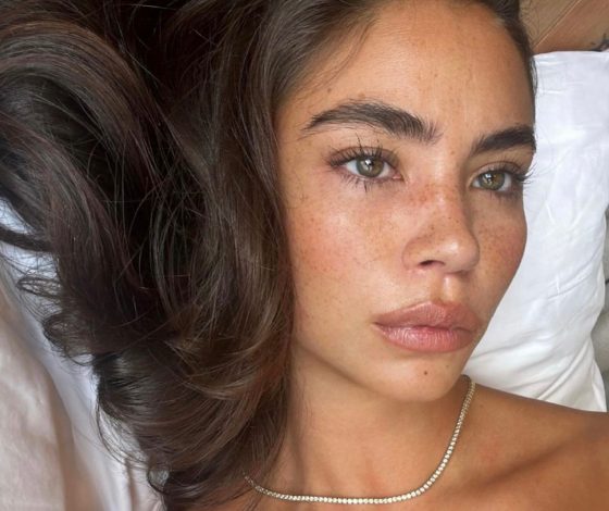 Гид по косметологическим пилингам для лица: какой кому подойдет