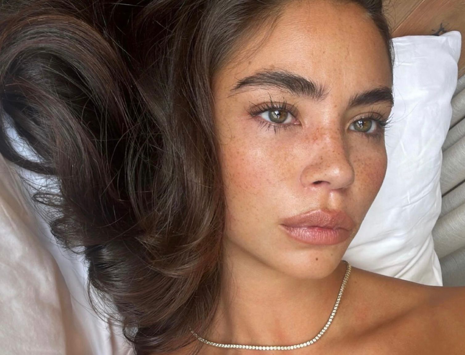Guide to cosmetic peeling for the face: which one is suitable for whom?