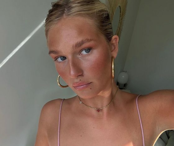 Ситуация help: как убрать засос на шее