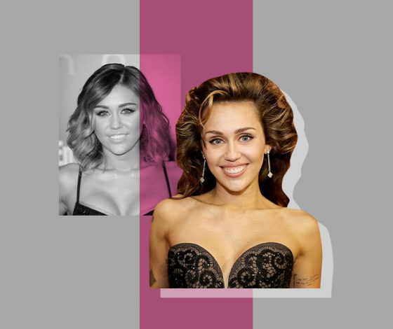 Какие пластические операции делала Майли Сайрус? Рассказывает эксперт