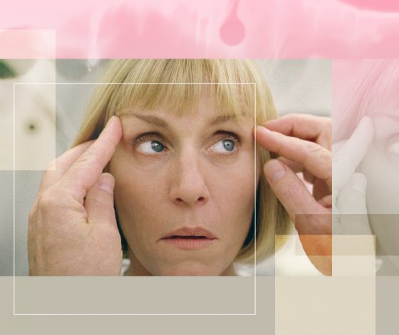 Болезнь соцсетей: что такое дисморфофобия и как люди живут с ней