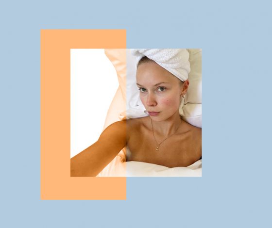 Какая косметика провоцирует появление пигментных пятен