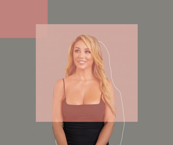 Что случилось с лицом Анны Седоковой? Отвечает пластический хирург