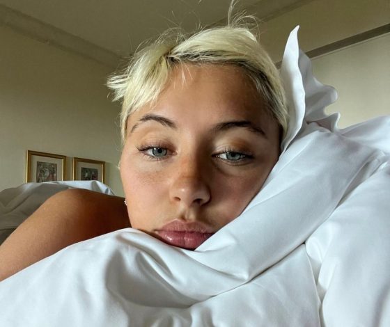 Что такое психодерматология, или Почему акне появляются из-за стресса