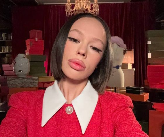 Инстасамка показала, как выглядела до популярности