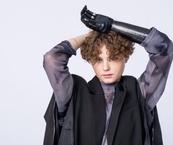 Звезда шоу «Пацанки» Александра Крючкова стала лицом бренда бионических протезов