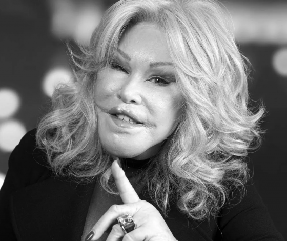 Умерла «женщина-кошка» Джослин Вильденштейн