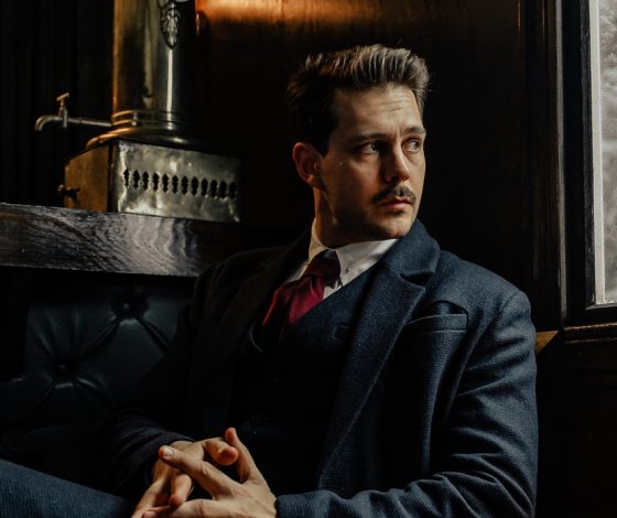 Милош Бикович пострадал на съемках: «Посекло лицо стеклами»