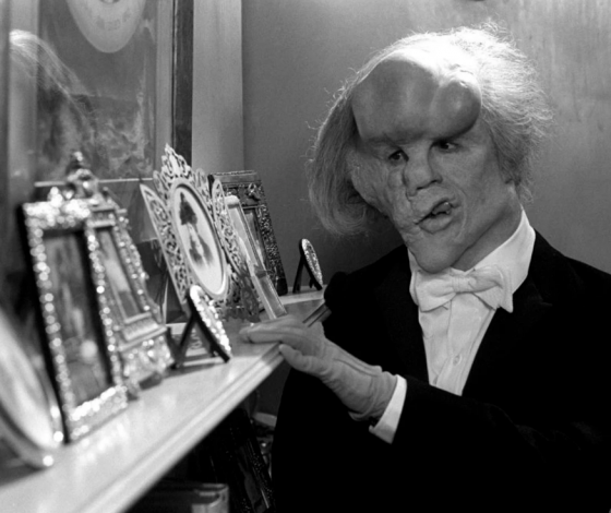 Не только Дэвид Линч: о «Человеке-слоне» снимут фильм