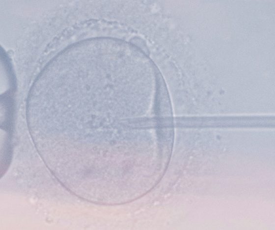 «За рождение»: ЭКО