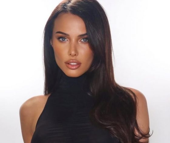 Анастасия Решетова показала фото до пластики