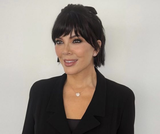 Как Крис Дженнер на самом деле выглядит после подтяжки