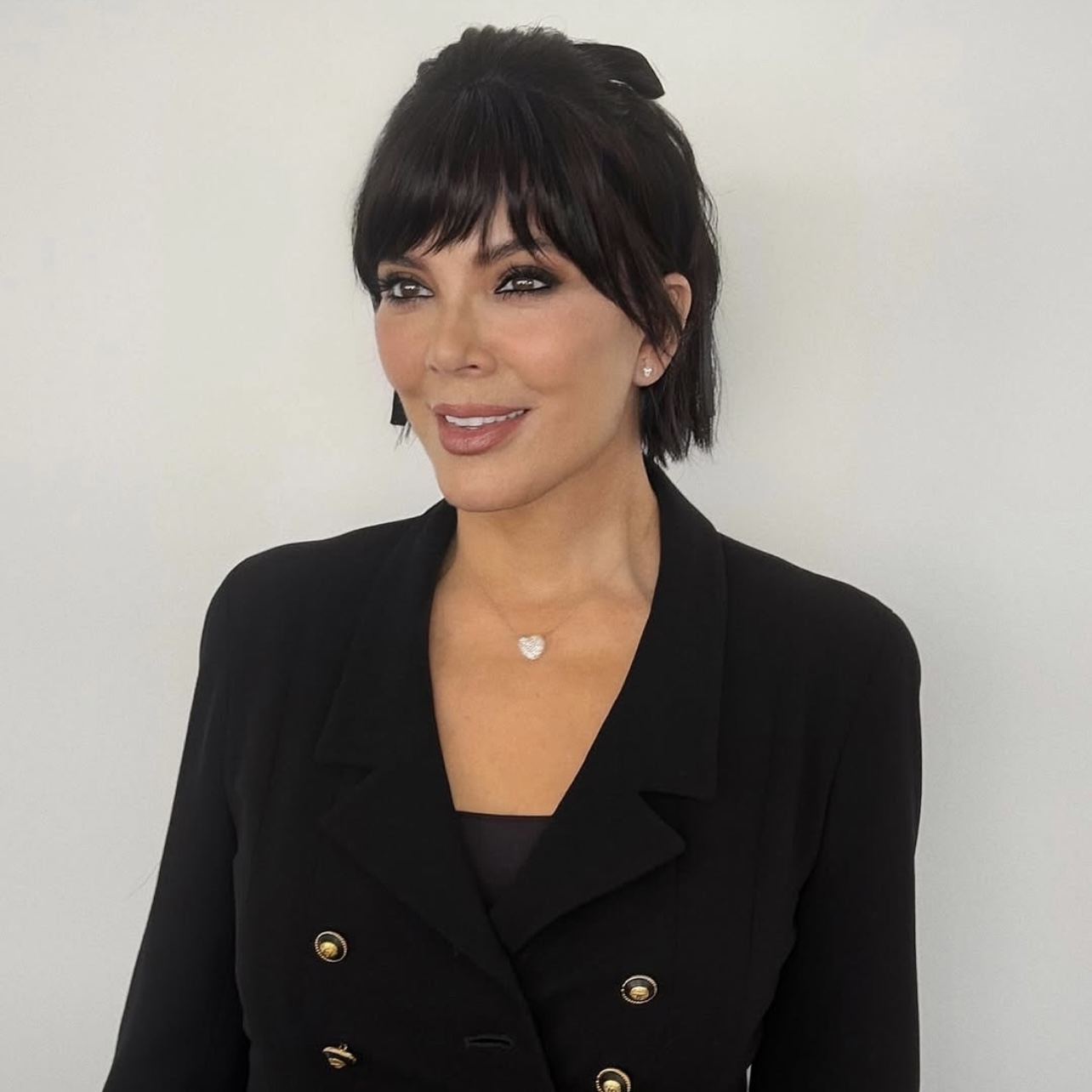 What Does Kris Jenner Really Look Like After Facelift?