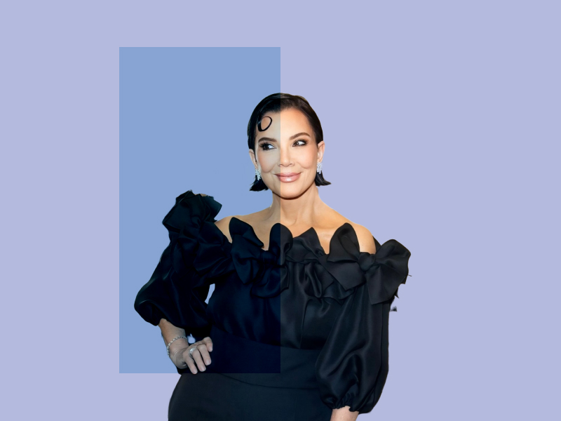 Chris Jenner’s “new” face: Which plastic surgery did the star? Chris Jenner’s “new” face: Which plastic surgery did the star?