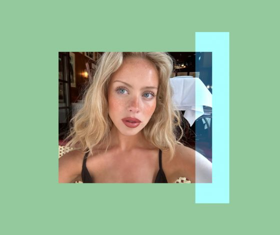 Почему блестит кожа и что с этим делать?