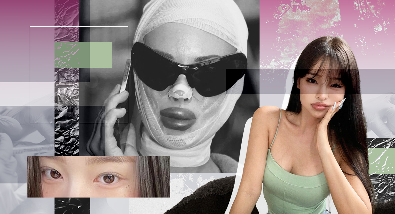 Beauty requires sacrifice: 5 most ruthless Korean beauty procedure