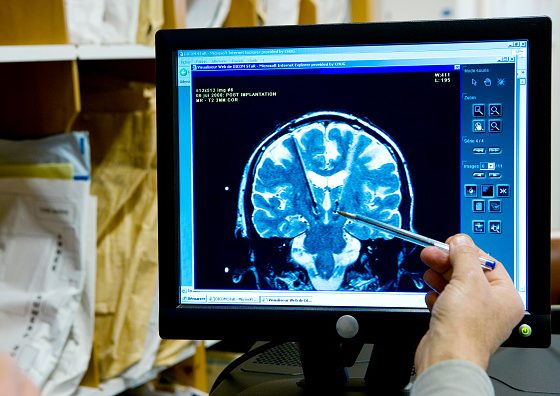 Как жара влияет на наш мозг