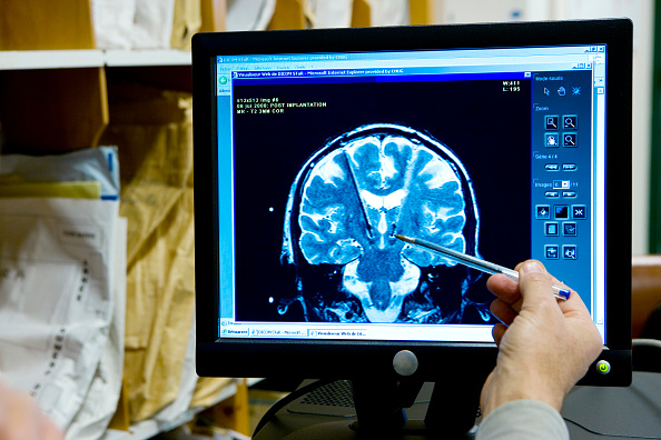 How does heat affect our brain