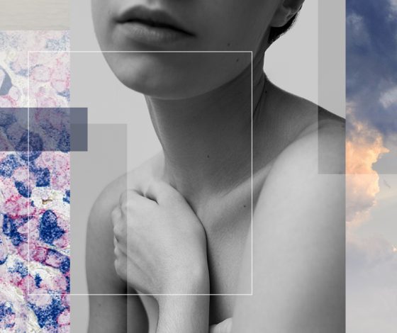 Победить рак груди – возможно: рекомендации специалистов и истории успешных женщин, которые ведут борьбу с болезнью