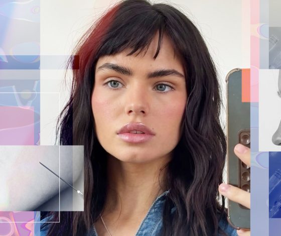 Что такое биоревитализация и кому она нужна? Мнение эксперта